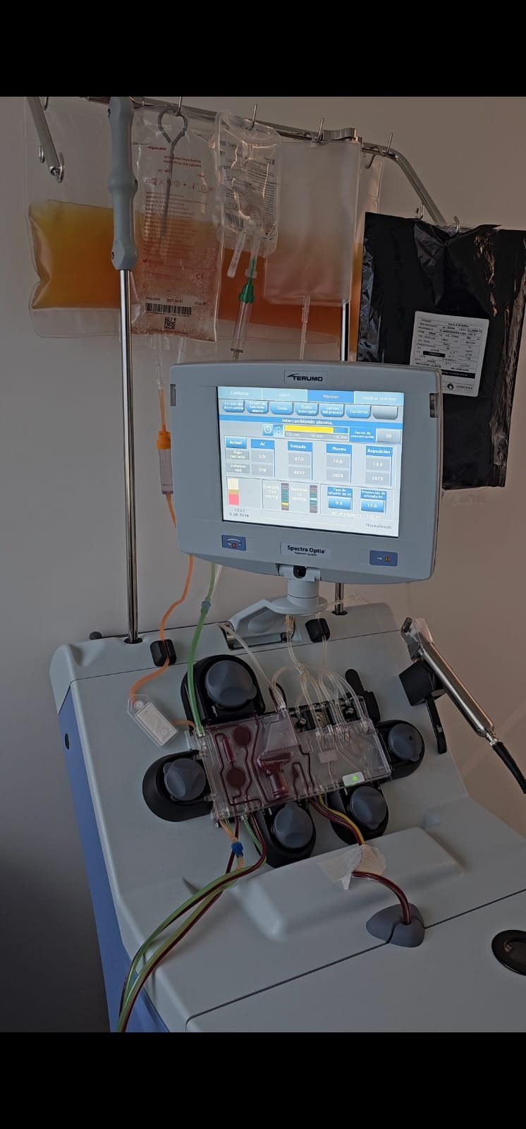 Spectra Optia — Terumo BCT apheresis system in operation during TPE